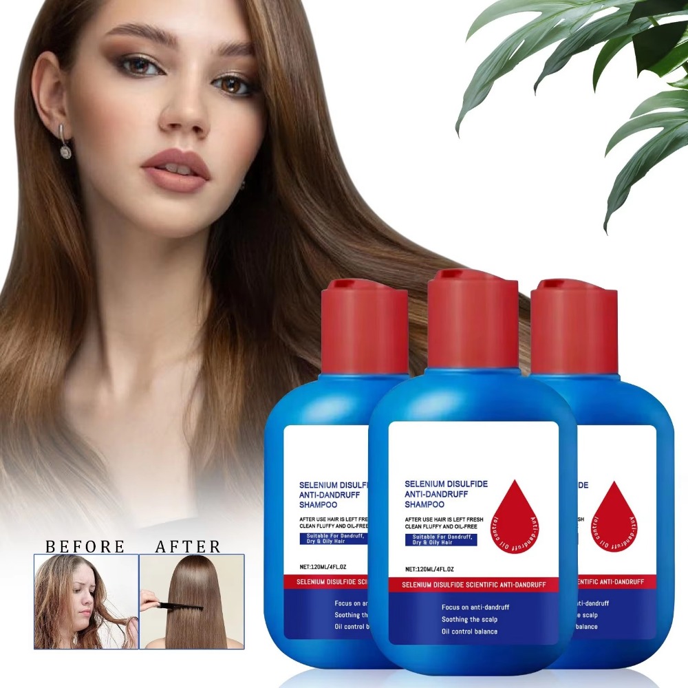 Hair Care Dandruff - 새로운 120ml 니포리 샴푸 오일 컨트롤